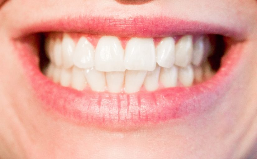 Aktualna technologia używana w salonach stomatologii estetycznej zdoła sprawić, że odzyskamy prześliczny uśmiech.